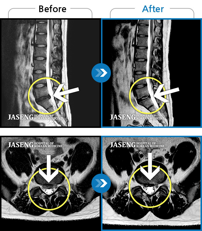 õڻѹ溴 ġ MRI  ġ-㸮 ؼ ŵ ȵſ. 