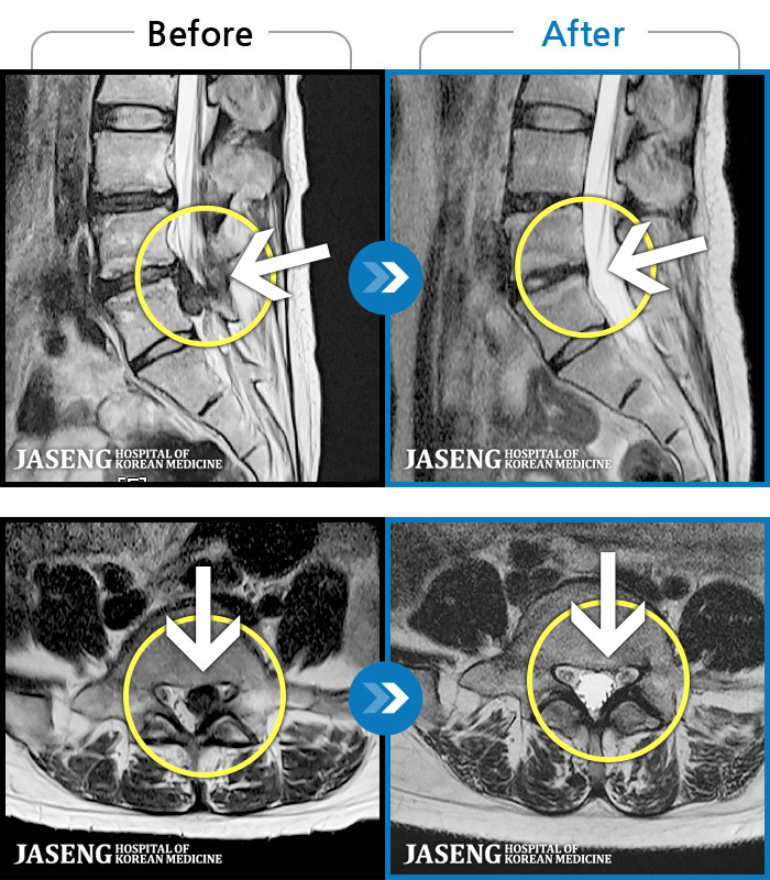 õڻѹ溴 ġ MRI  ġ û-  Ƹ ϰ   ־.