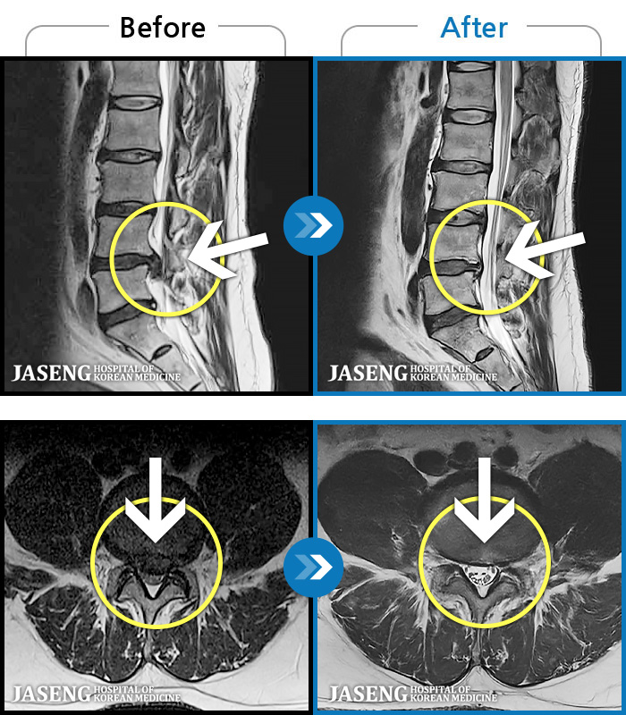 ڻѹ溴 ġ MRI ġ- ο ߰ .