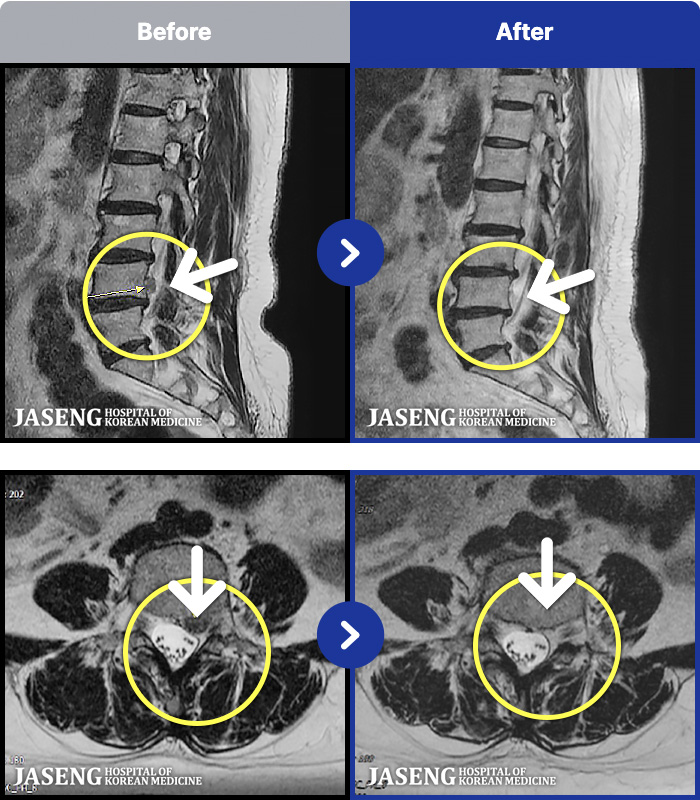 õڻѹ溴 ġ MRI ġ-㸮 ʹ ٸ