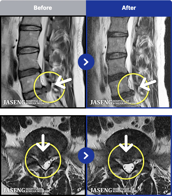 â���ڻ��ѹ溴�� ġ���� MRI�� ���� ġ����-���� ���� �� ���� �����ĸ�� �� ��ü�� ����, �ٷ�����