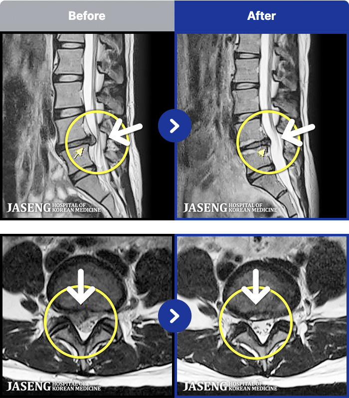 ڻѹ溴 ġ MRI ġ- 1 ʴ 㸮 , ̾ ɾҴ Ͼ ȭǾ ϼ̽ϴ.