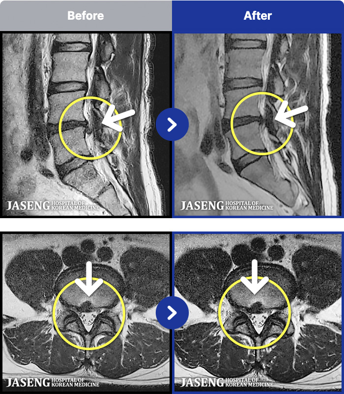 �ϻ��ڻ��ѹ溴�� ġ���� MRI�� ���� ġ����-���� ��� ������ ���ϰ� ���� ������ ���� �� ������ ���ӵǸ� ���� ������ �ٷ� �� ���� ����