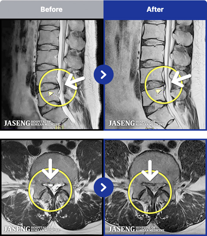 �����ڻ��ѹ溴�� ġ���� MRI�� ���� ġ����-���� �㸮���� ���, ��������� �̾����� �������� ��� �� ���� ��ȭ�Ǿ� �����ϼ̽��ϴ�.