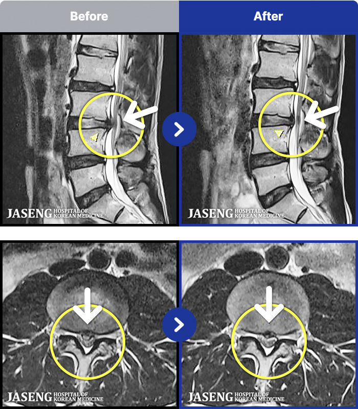 �����ڻ��ѹ溴�� ġ���� MRI�� ���� ġ����-�㸮���� ��� ����,  ���� �� ���� �ٸ� ������ ���� ��ȭ�Ǿ� �����ϼ̽��ϴ�.