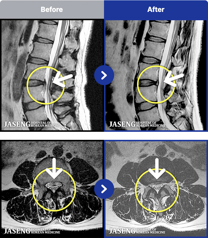 �Ȼ��ڻ��ѹ溴�� ġ���� MRI�� ���� ġ����-���� ��ݺ��� �ٸ������� ������ ���������� �ȱⰡ �����.