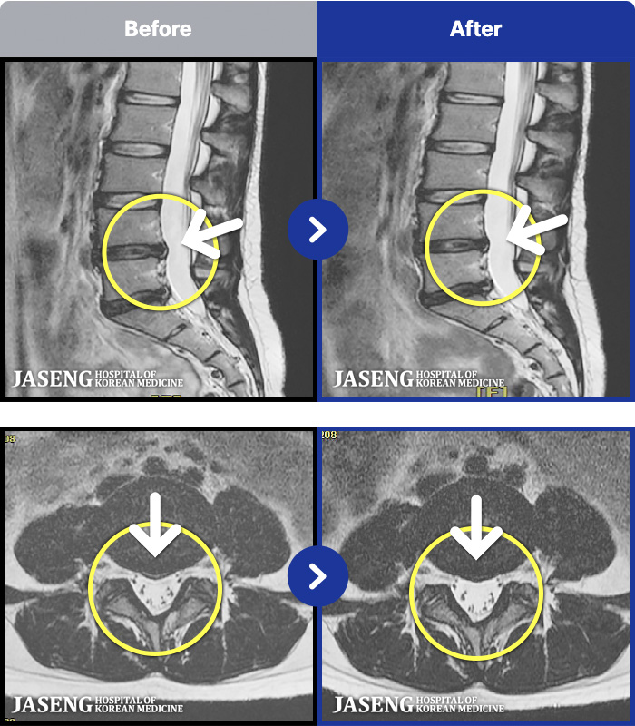 ��õ�ڻ��ѹ溴�� ġ���� MRI�� ���� ġ����-���� ��� �㸮 �Ʒ��ʿ� ������ ���� ������ �ȱ� ����� ���¿����ϴ�