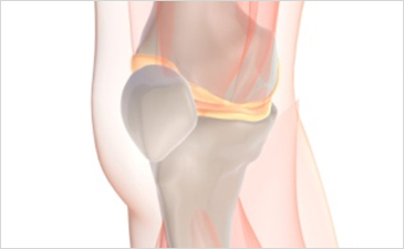 광주자생한방병원 무릎질환 무릎점액낭염-무릎점액낭염 관련 사진 입니다.