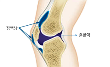 광주자생한방병원 무릎질환 무릎점액낭염-점액낭과 윤활액이 위치해 있는 무릎 설명 이미지