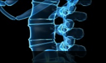 광주자생한방병원 허리질환 척추전방전위증-정상적인 사람의 척추뼈 모습입니다.